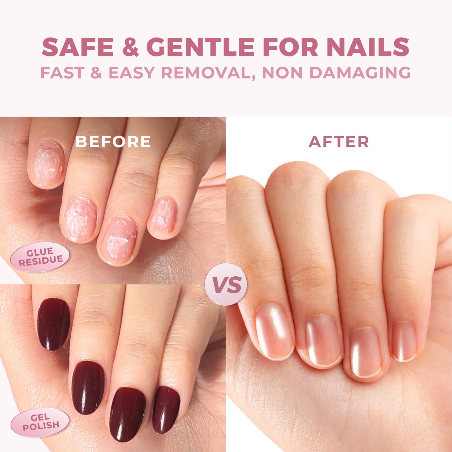 2-in-1 Eze Remover (Pembersih Bekas Lem Kuku Palsu & Gel Nails Remover)